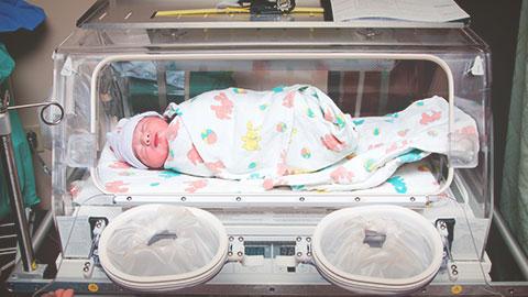 ¿Cómo es el aspecto físico de un bebe prematuro