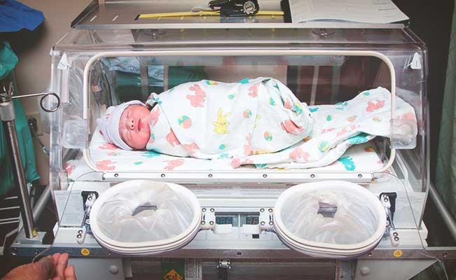 ¿Cómo es el aspecto físico de un bebe prematuro